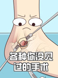 各种你没见过的手术封面图